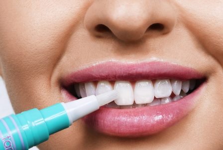 Мифы о отбеливании зубов.