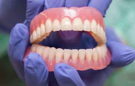Съемные акриловые зубные протезы: надежность, комфорт и эстетика.
